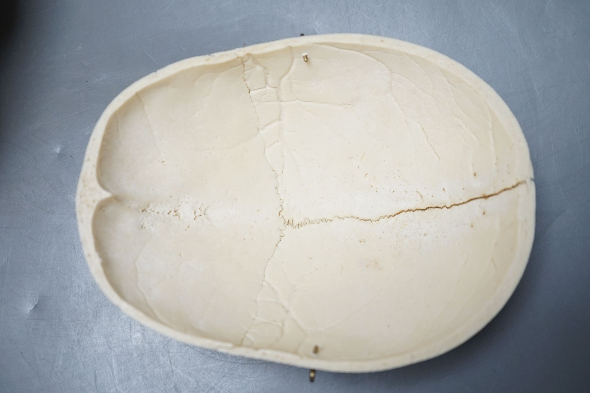 A human skull, acquired c.1976., 14 cms high x 19.5 wide.